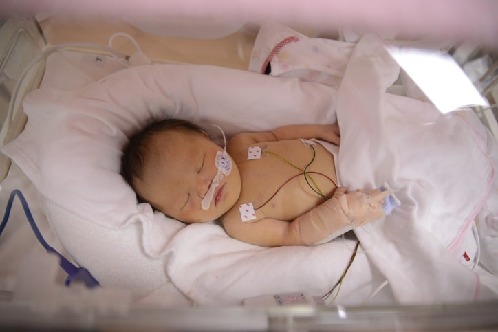 Baby with Oxygen Deprivation