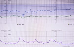Fetal Monitoring results on a screen